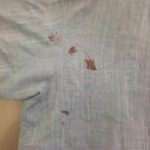 麻のシャツに血液のシミ